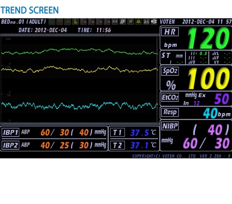 Monitor theo dõi bệnh nhân VP-700
