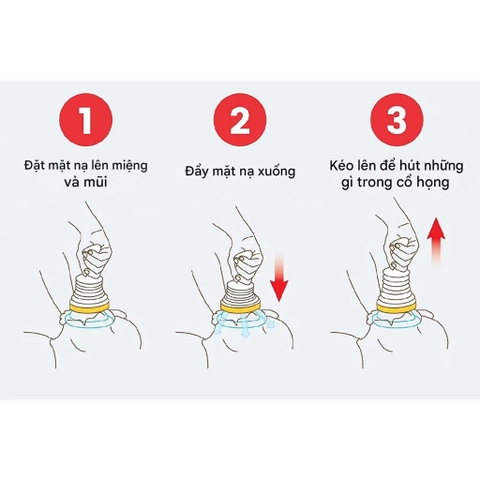 Thiết Bị Sơ Cứu Chống Nghẹn Hóc, Dụng Cụ Hút Dị Vật Mắc Cổ Họng Tại Nhà Cho Trẻ Em/Người lớn