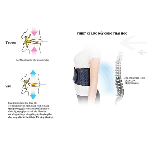 Đai Hơi Điều Chỉnh Cột Sống Giúp Điều Trị Đau Lưng Do Thoát Vị Đĩa Đệm, Đẩy Lùi Thoái Hóa