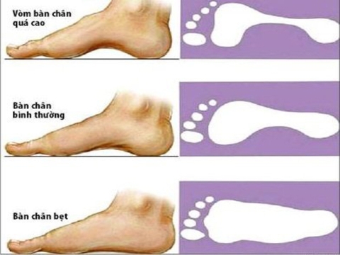 CHỌN DÉP ĐẾ TRẤU NAM NỮ ĐỂ BẢO VỆ SỨC KHỎE BÀN CHÂN