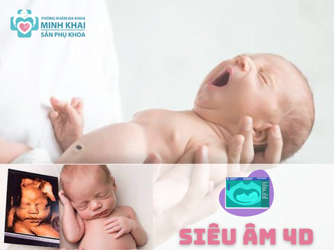 Siêu Âm 4D Là Gì? Khi Nào Nên Đi Siêu  Âm Thai 4D?