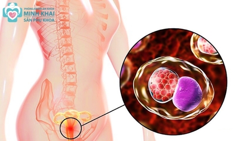 Bệnh Xã Hội Là Gì? Dấu Hiệu, Tác Hại Và Cách Phòng Tránh Hiệu Quả