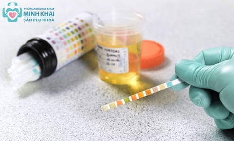 Cách Làm Giảm Protein Trong Nước Tiểu Khi Mang Thai