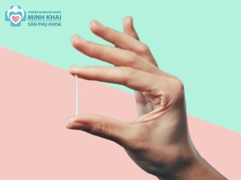 Cấy Que Tránh Thai Có Được Xuất Vào Trong Không