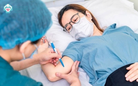 Có Nên Cấy Que Tránh Thai Không? Những Điều Cần Biết Khi Cấy Que Tránh Thai