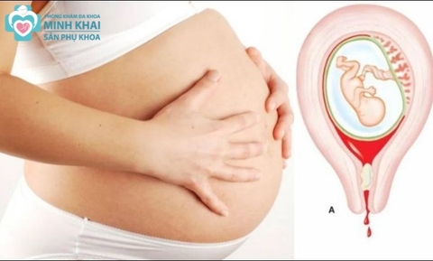 Những Dấu Hiệu Bất Thường Khi Mang Thai 3 Tháng Giữa Mẹ Bầu Nên Biết