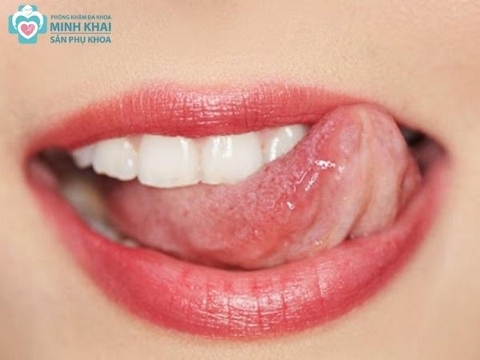 Quan hệ đồng tính có bị nhiễm HIV không?