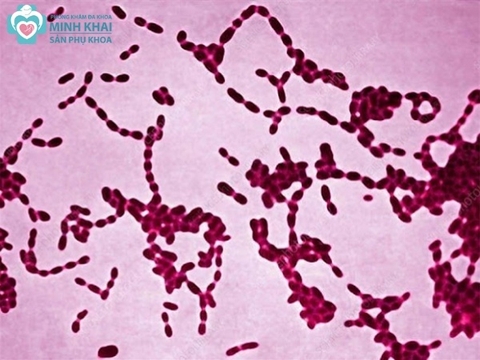 Tìm hiểu bệnh hạ cam mềm ở nam giới