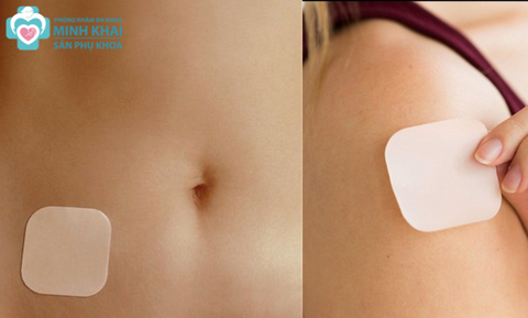 Cách Sử Dụng Miếng Dán Tránh Thai Hiệu Quả Và An Toàn