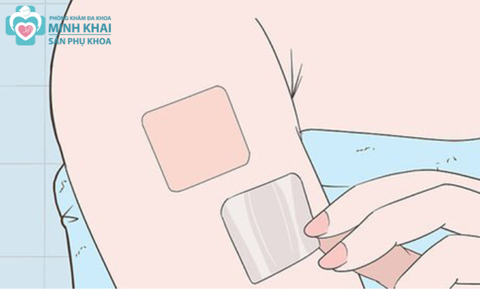 Cách Dùng Và Lưu Ý Khi Dùng Miếng Dán Tránh Thai Evra Hiệu Quả