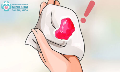 Dọa Sảy Thai Là Gì? Nguyên Nhân, Dấu Hiệu, Cách Điều Trị?