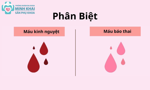 Cách Phân Biệt Máu Báo Thai Và Máu Kinh Chị Em Cần Biết