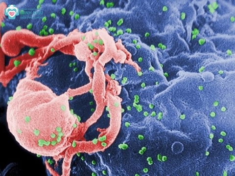 Biểu hiện của hiv ở nam giới giai đoạn đầu