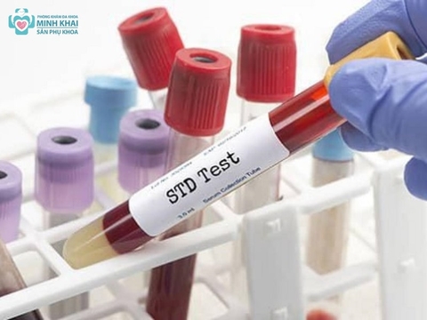 Nghi ngờ nhiễm HIV sau quan hệ phải làm sao?