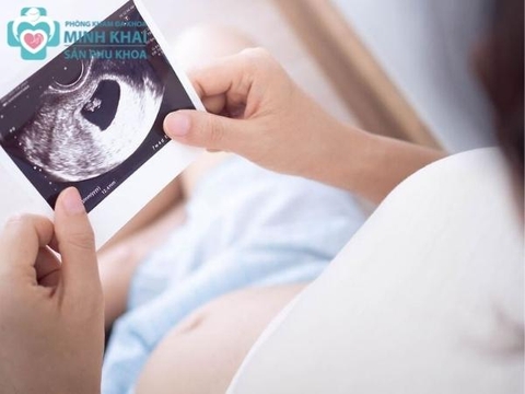 Thời gian khám thai định kỳ mà mẹ bầu không nên bỏ qua