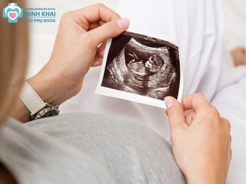 Siêu Âm 2D Là Gì Và Những Điều Mẹ Bầu Cần Biết