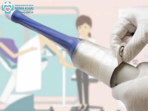 Siêu Âm Đầu Dò  Âm Đạo Và Những Điều Cần Biết