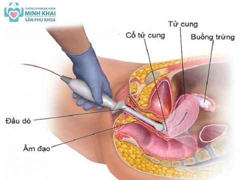 Siêu Âm Thai Và Những Lưu Ý Mẹ Bầu Cần Biết