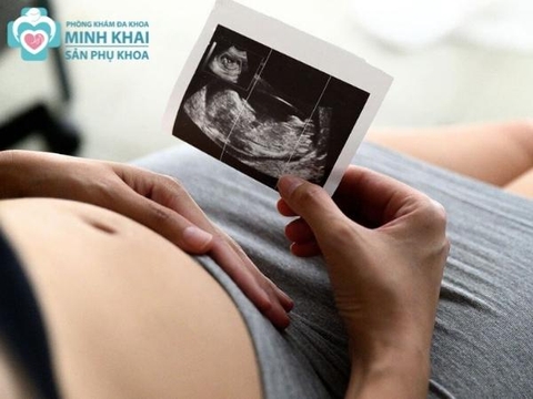 Nên đi siêu âm thai lần đầu khi nào?