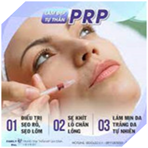 PRP  ĐIỀU TRỊ SẸO RỔ NHIỀU CẤP ĐỘ, TRẺ HÓA, PHỤC HỒI TÁI TẠO DA. CĂN BÓNG