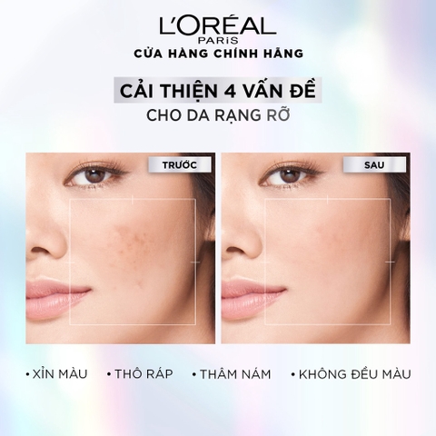 Serum LOreal Paris Dưỡng Sáng Và Mờ Thâm Nám 30ml