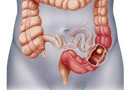 Ruột có sạch thì cơ thể mới khỏe: 7 thực phẩm giúp thải độc ruột hiệu quả ai cũng nên ăn