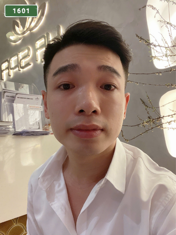 번호 1601 : 베트남 꽝남 자택과 호텔에서 마사지