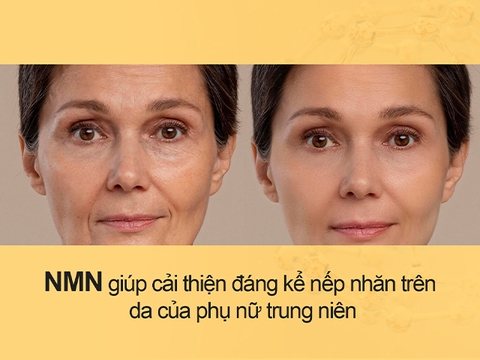 MỸ PHẨM NMN CHỈ LÀ “HOT TREND” HAY THẬT SỰ CÓ HIỆU QUẢ?