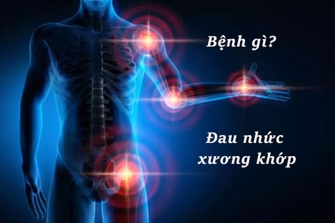 Giải Pháp Mới Hỗ Trợ Cho Bệnh Xương Khớp, Bạn Biết Chưa?