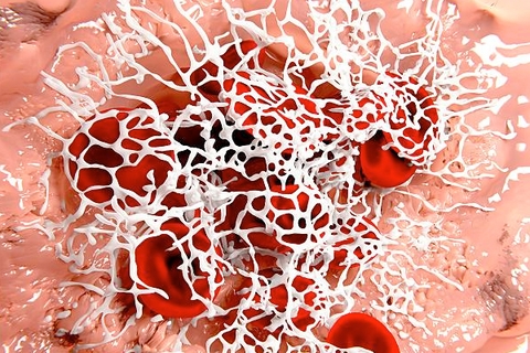 Fibrin là gì? Những điều cần biết về Fibrin