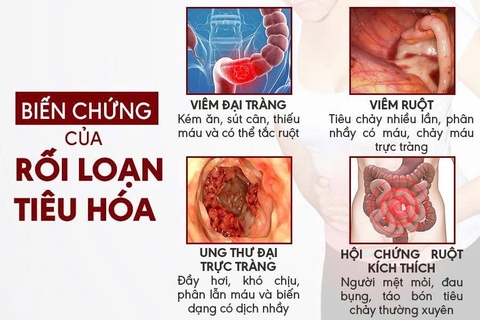 NGUYÊN NHÂN VÀ TRIỆU CHỨNG ĐIỂN HÌNH CỦA BỆNH RỐI LOẠN TIÊU HÓA
