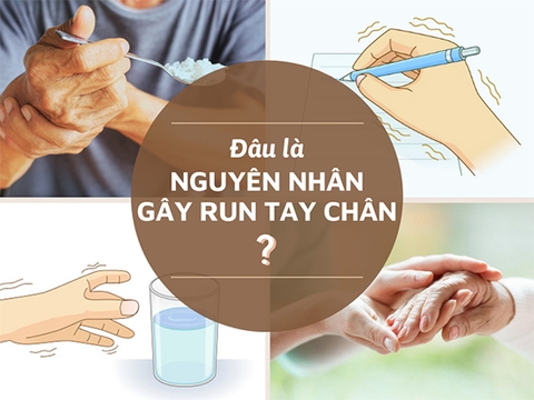 Bệnh sử hiện tại của run tay liên quan đến thần kinh