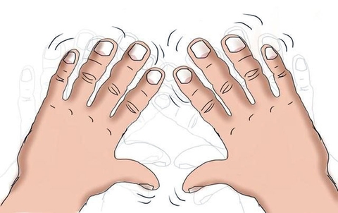 9 nguyên nhân khiến tay run, chớ nên xem thường!