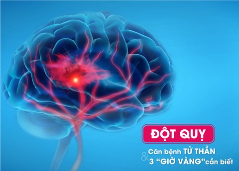 Các triệu chứng đột quỵ nhẹ