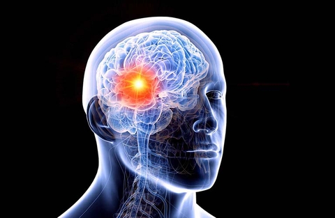 Tiểu não cổ (tiểu não tiền đinh)