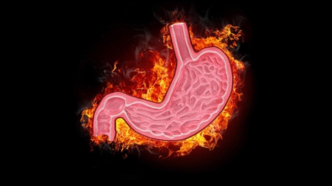 Rối loạn thần kinh thực vật- Bệnh dễ bị chẩn đoán “nhầm”