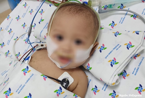 Viêm màng não nhiễm khuẩn ở trẻ sơ sinh trên 3 tháng tuổi