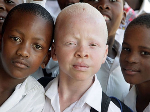 Bệnh hiếm và ngày bệnh hiếm