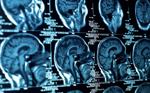 Chức năng của não người