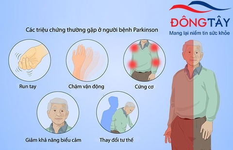 BỆNH PARKINSON GIAI ĐOẠN ĐẦU: DẤU HIỆU, CHẨN ĐOÁN VÀ CÁCH ĐIỀU TRỊ