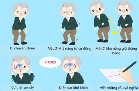 BỆNH PARKINSON Ở NGƯỜI TRẺ: NGUYÊN NHÂN, DẤU HIỆU VÀ CÁCH ĐIỀU TRỊ