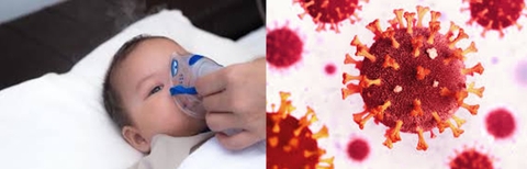 HƯỚNG DẪN CHẨN ĐOÁN VÀ XỬ TRÍ BỆNH VIÊM NÃO CẤP Ở TRẺ EM