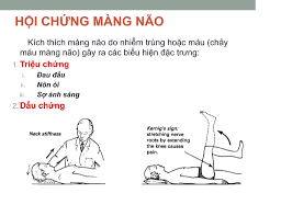 Phòng ngừa viêm màng não do vi khuẩn ở trẻ sơ sinh