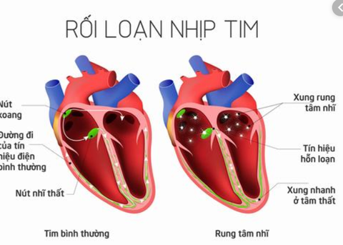 Rối loạn thần kinh thực vật có chữa được không?