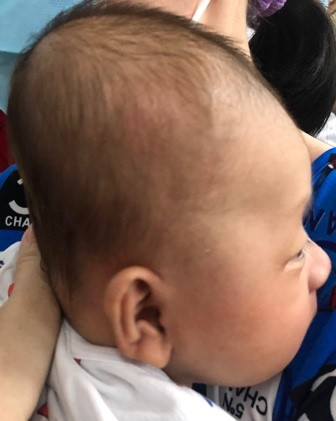 Bệnh viêm não cấp ở trẻ nguy hiểm thế nào?