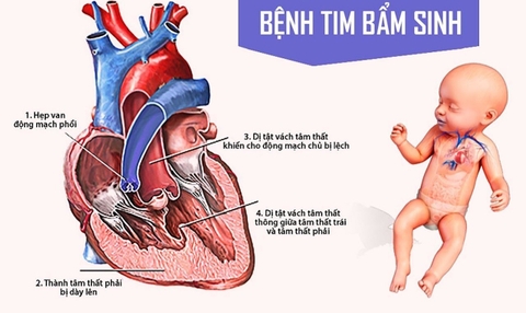 5 cách đơn giản để phòng ngừa bệnh tim mạch