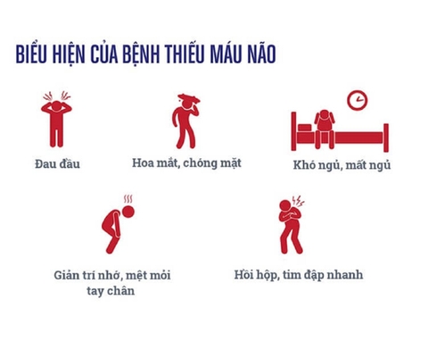 cách trị thiếu máu não tại nhà