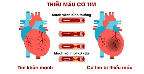 Thuốc bổ tim Zimasum có tốt không