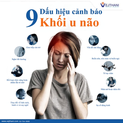 Cảnh báo một số bệnh lý về não từ dấu hiệu thường xuyên chóng mặt, đau đầu