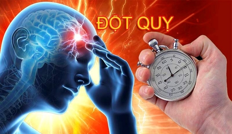 Dược phẩm chống đột quỵ của mỹ tốt trên thị trường